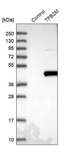 TFB2M Antibody in Western Blot (WB)