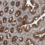 ZNF7 Polyclonal Antibody