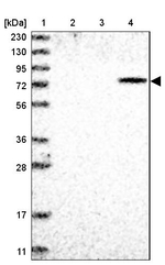 ZNF7 Antibody in Western Blot (WB)