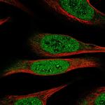DEAF1 Antibody in Immunocytochemistry (ICC/IF)