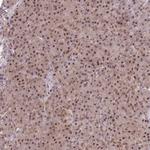 DEAF1 Antibody in Immunohistochemistry (Paraffin) (IHC (P))