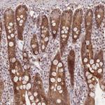 DEAF1 Antibody in Immunohistochemistry (Paraffin) (IHC (P))