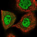 Menin Polyclonal Antibody