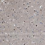 Menin Antibody in Immunohistochemistry (Paraffin) (IHC (P))