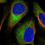 TSC2 Antibody in Immunocytochemistry (ICC/IF)