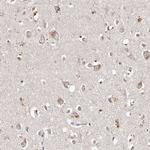TSC2 Antibody in Immunohistochemistry (Paraffin) (IHC (P))