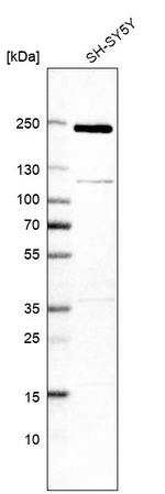 TSC2 Antibody in Western Blot (WB)