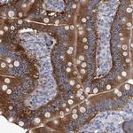 XPNPEP1 Antibody in Immunohistochemistry (Paraffin) (IHC (P))