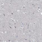 Prostasin Antibody in Immunohistochemistry (Paraffin) (IHC (P))