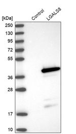Galectin 8 Antibody in Western Blot (WB)