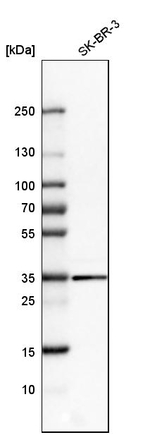 Galectin 8 Antibody in Western Blot (WB)