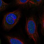 DSN1 Polyclonal Antibody