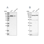 OGT Antibody in Western Blot (WB)