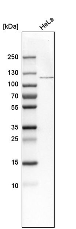OGT Antibody in Western Blot (WB)