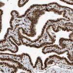 CKS2 Antibody in Immunohistochemistry (Paraffin) (IHC (P))