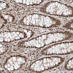 CKS2 Antibody in Immunohistochemistry (Paraffin) (IHC (P))