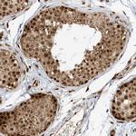 CKS2 Polyclonal Antibody