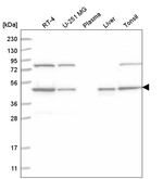 NCK1 Antibody in Western Blot (WB)