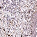 COL5A1 Antibody in Immunohistochemistry (Paraffin) (IHC (P))