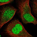 IRF2 Polyclonal Antibody