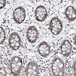 IRF2 Antibody in Immunohistochemistry (Paraffin) (IHC (P))