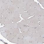 IRF2 Antibody in Immunohistochemistry (Paraffin) (IHC (P))