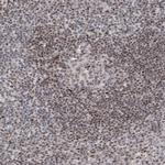 IRF2 Antibody in Immunohistochemistry (Paraffin) (IHC (P))