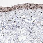 IRF2 Antibody in Immunohistochemistry (Paraffin) (IHC (P))