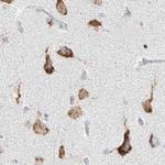 LRRC59 Antibody in Immunohistochemistry (Paraffin) (IHC (P))