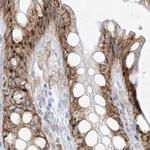 LRRC59 Antibody in Immunohistochemistry (Paraffin) (IHC (P))