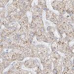 LRRC59 Antibody in Immunohistochemistry (Paraffin) (IHC (P))
