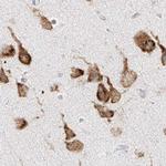 LRRC59 Antibody in Immunohistochemistry (Paraffin) (IHC (P))