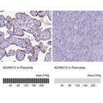 ADAM12 Antibody