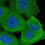 ADAM12 Polyclonal Antibody