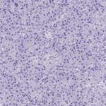 ADAM12 Antibody in Immunohistochemistry (Paraffin) (IHC (P))