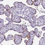 ADAM12 Antibody in Immunohistochemistry (Paraffin) (IHC (P))