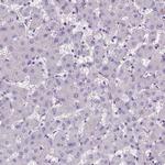 ADAM12 Antibody in Immunohistochemistry (Paraffin) (IHC (P))