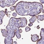 ADAM12 Polyclonal Antibody