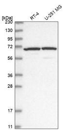 ADAM12 Antibody in Western Blot (WB)