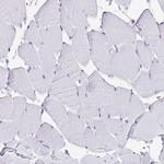 Cytokeratin 13 Antibody in Immunohistochemistry (Paraffin) (IHC (P))