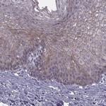 RIPK4 Antibody in Immunohistochemistry (Paraffin) (IHC (P))