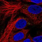 ZPR1 Polyclonal Antibody