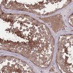 ZPR1 Antibody in Immunohistochemistry (Paraffin) (IHC (P))