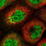 HDAC5 Antibody in Immunocytochemistry (ICC/IF)