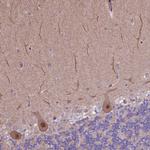 HDAC5 Antibody in Immunohistochemistry (Paraffin) (IHC (P))