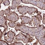 HDAC5 Antibody in Immunohistochemistry (Paraffin) (IHC (P))