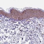 HDAC5 Antibody in Immunohistochemistry (Paraffin) (IHC (P))