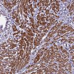 Bcl-rambo Antibody in Immunohistochemistry (Paraffin) (IHC (P))