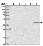 Bcl-rambo Antibody in Western Blot (WB)