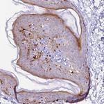 NCK2 Antibody in Immunohistochemistry (Paraffin) (IHC (P))